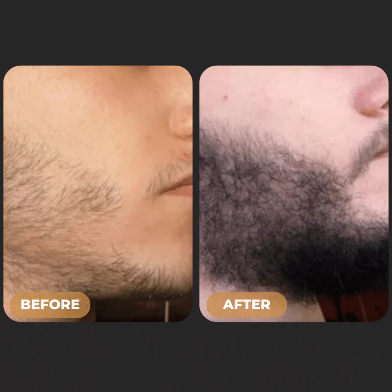 SPARTAN™ - Beard Growth Oil - Image 3