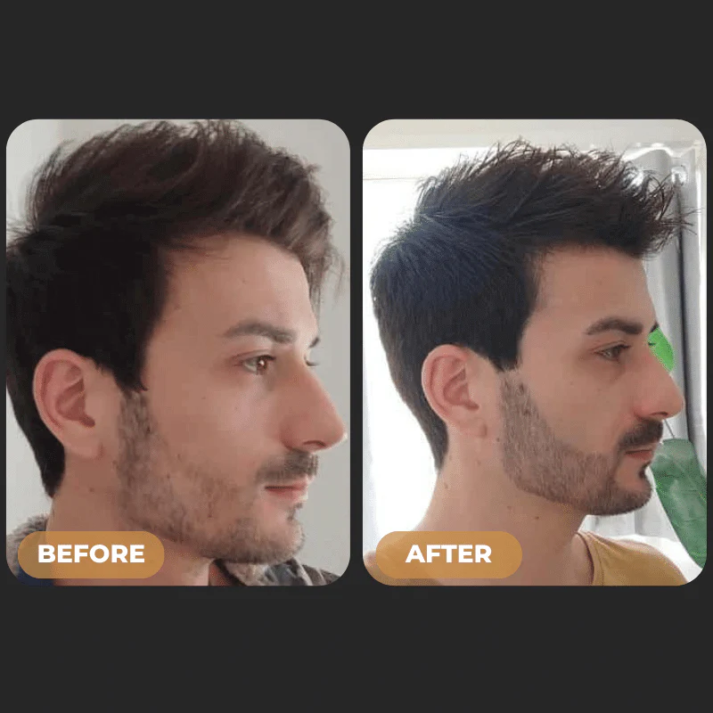 SPARTAN™ - Beard Growth Oil - Image 4