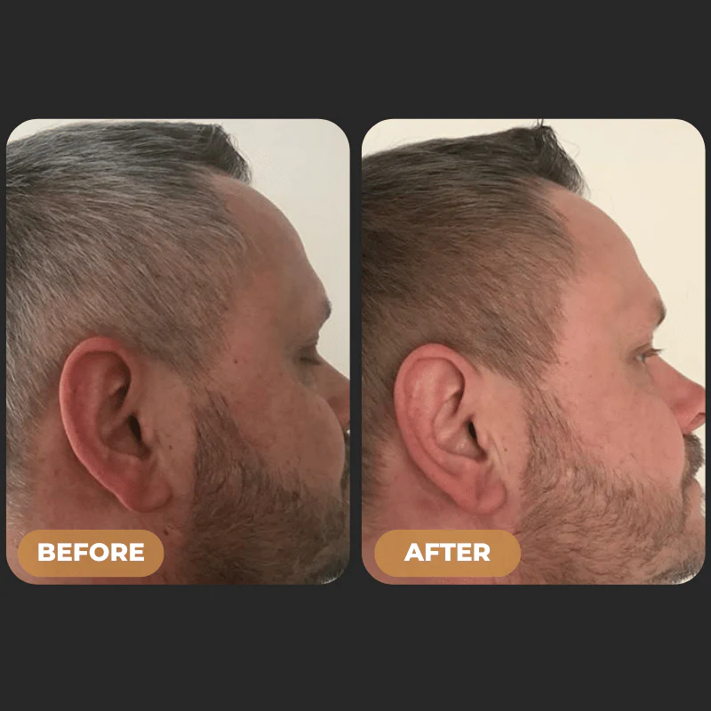 SPARTAN™ - Instant Hair Dye Shampoo - Image 6