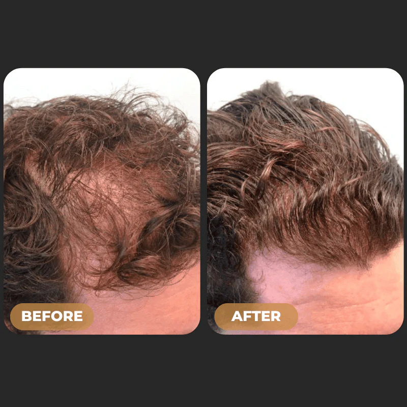 SPARTAN™ - Root Activator Spray - Image 3
