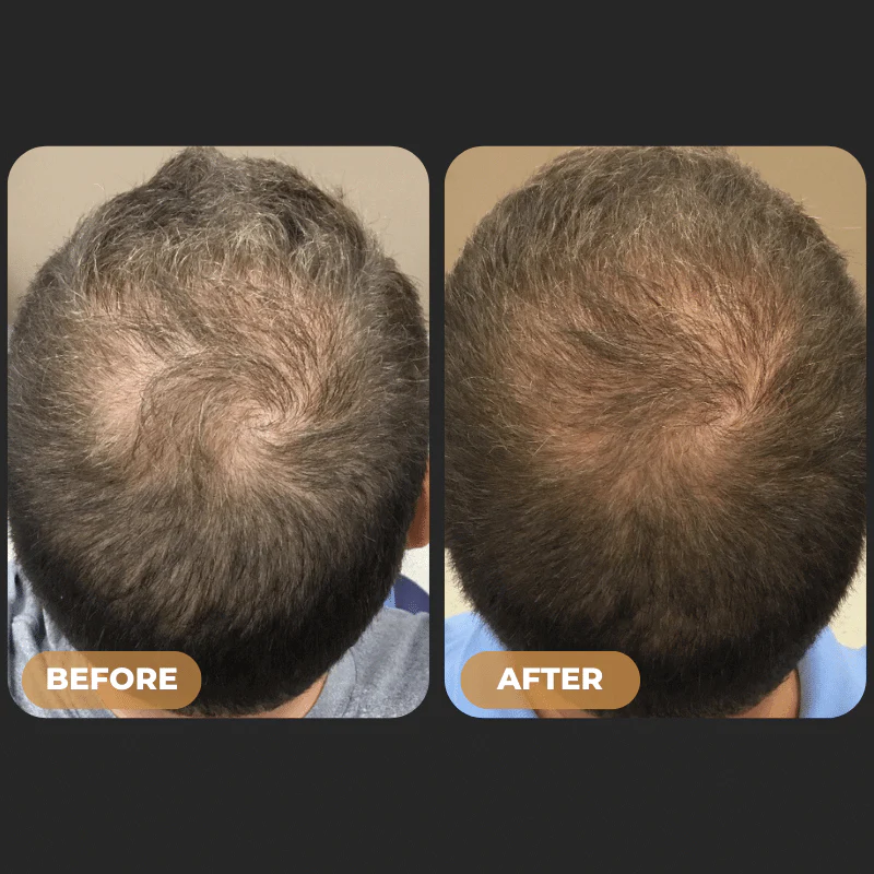 SPARTAN™ - Root Activator Spray - Image 5